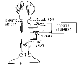 Diagram of severed head kept alive by machine
